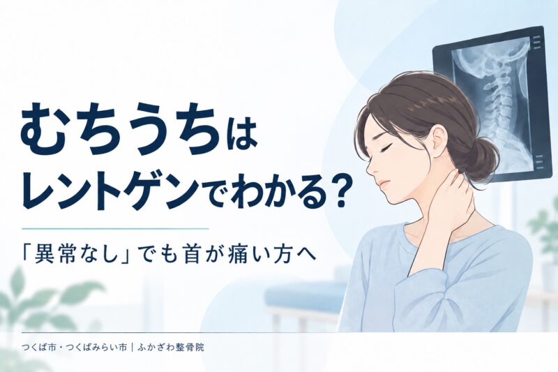 むちうちはレントゲンでわかる？「異常なし」でも首が痛いときの確認事項